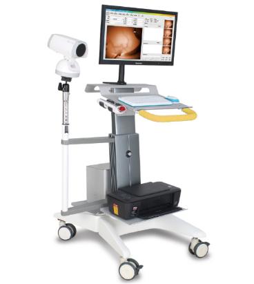 徐州益柯達(dá)紅外乳腺檢查儀YKD-1001