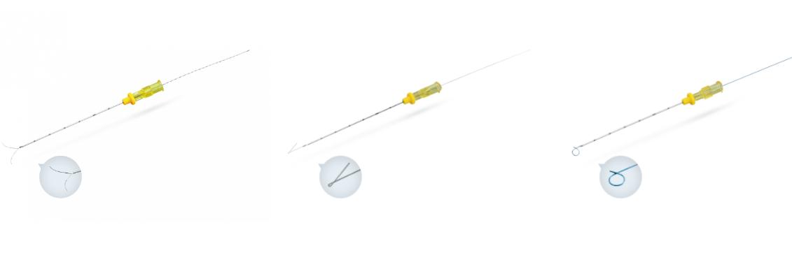 浙江伽奈维一次性使用乳腺定位丝及其导引针GW-Q 18-150