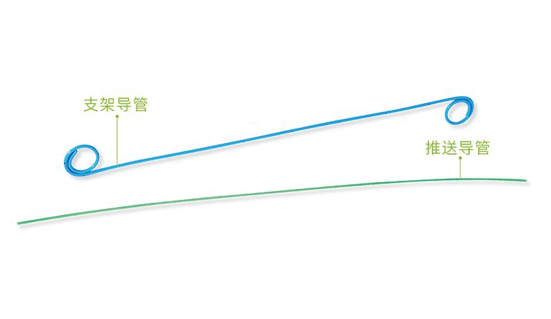 北京德邁特一次性使用J型導尿管輸尿管支架導管4.7Fr