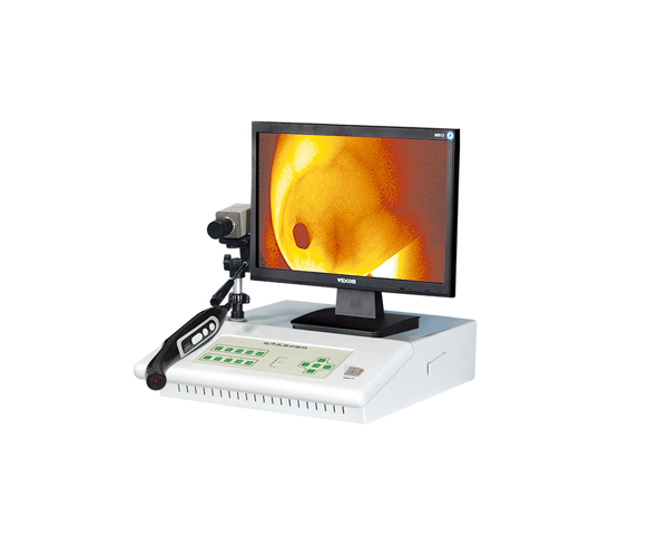徐州寶興紅外乳腺診斷儀RY-1100A