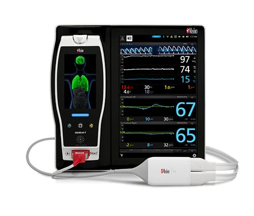 邁心諾Masimo腦部與區(qū)域血氧監(jiān)護(hù)儀O3