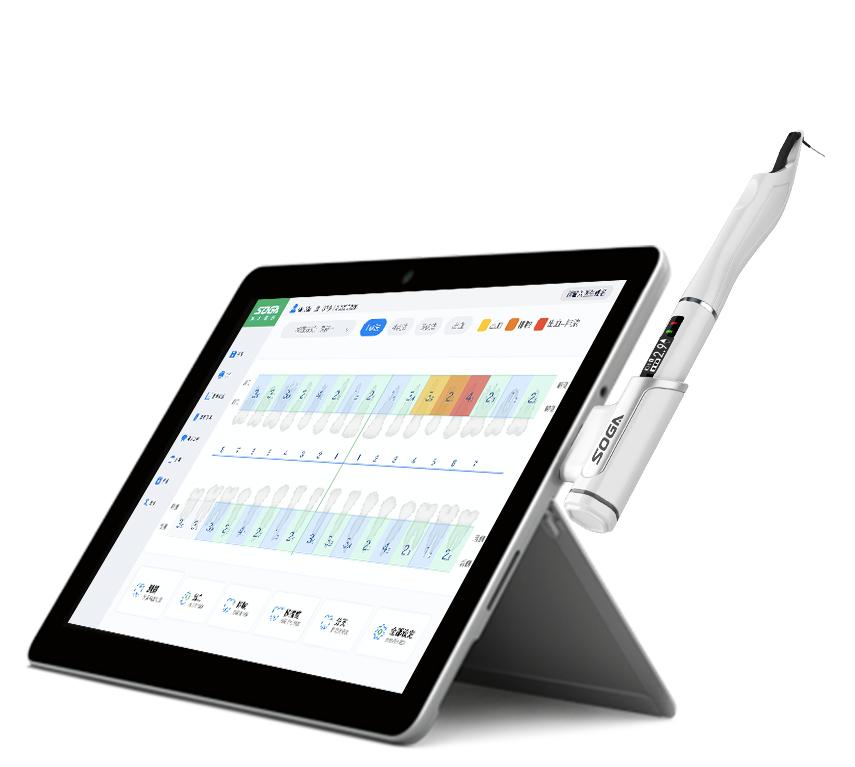 深圳索感牙周袋深度探測儀SOGA-T1