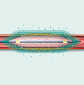 德國凱德諾CARDIONOVUM紫杉醇釋放高壓分流球囊擴(kuò)張導(dǎo)管APS400-20OTW