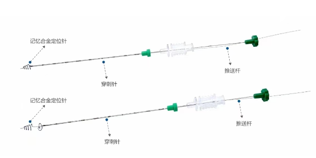 蘇州鑫斯達(dá)一次性使用肺結(jié)節(jié)記憶合金定位針A-50