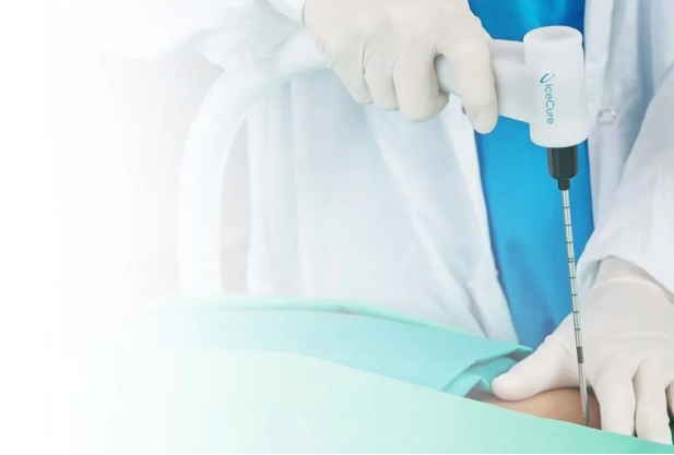 以色列愛斯科IceCure液氮外科冷凍治療設(shè)備IceSense 3